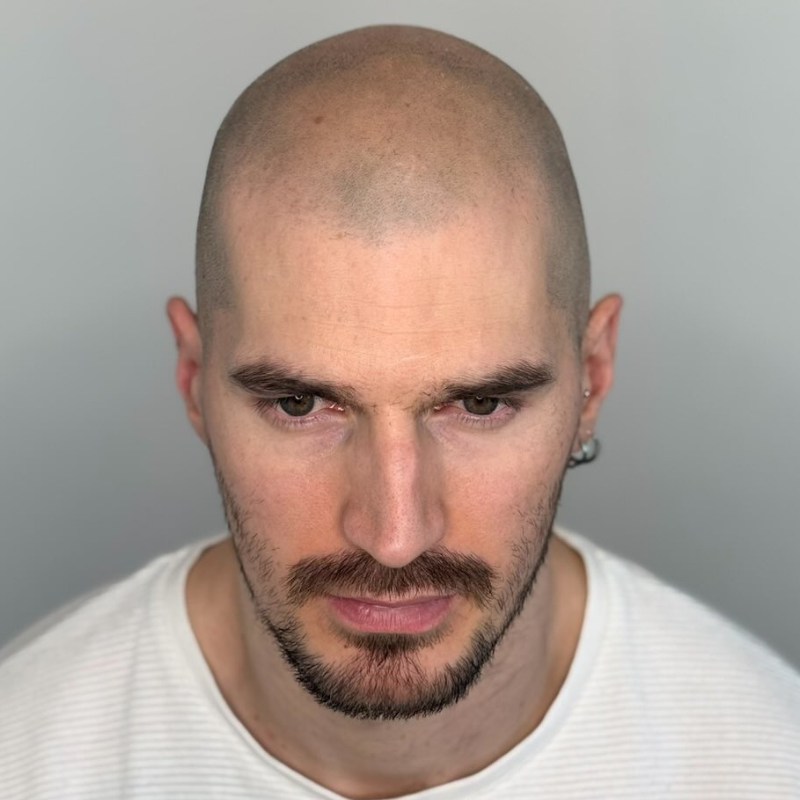 Effet rasé - micropigmentation capillaire